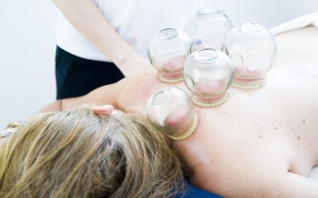 cupping-therapy-6604217_1920
